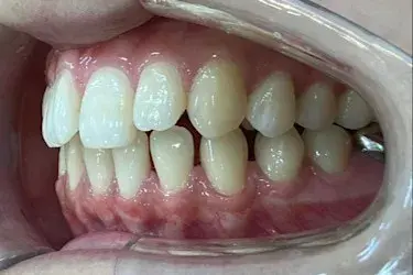 Before Image