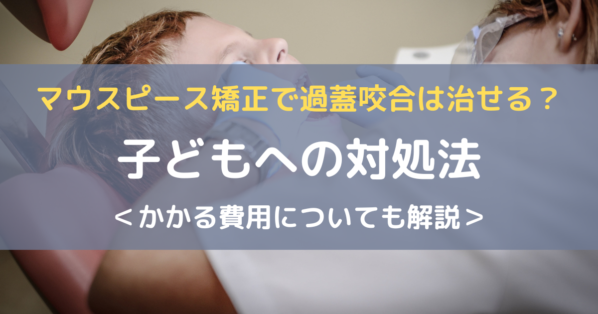 過蓋咬合マウスピースアイキャッチ画像