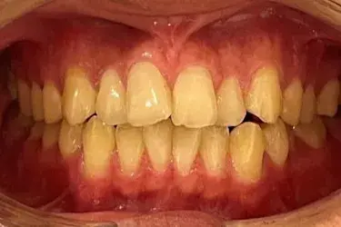 Before Image