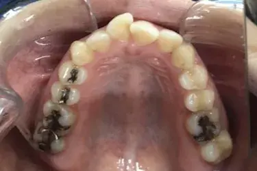 Before Image