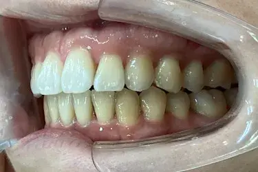 After Image