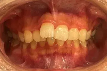 Before Image