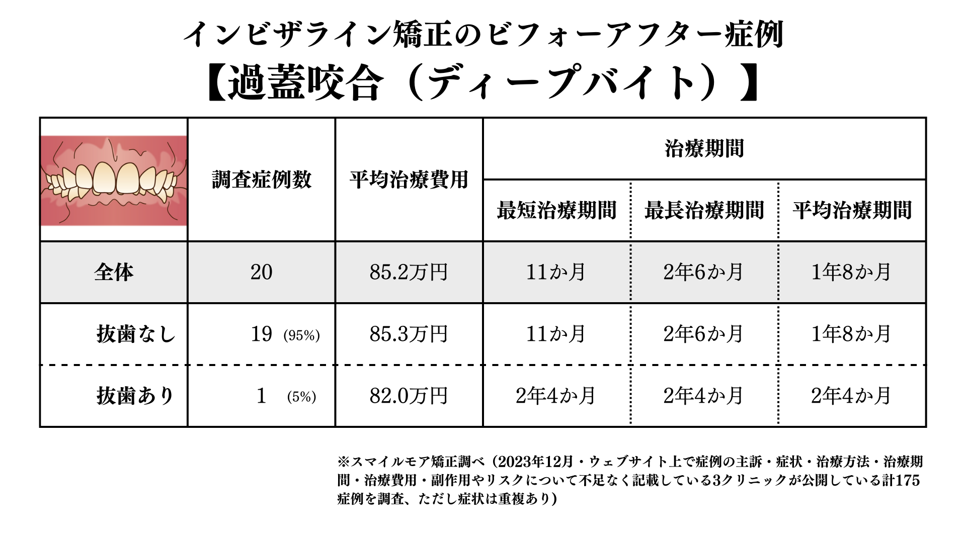 インビザライン矯正の過蓋咬合のビフォアーアフター症例調査結果