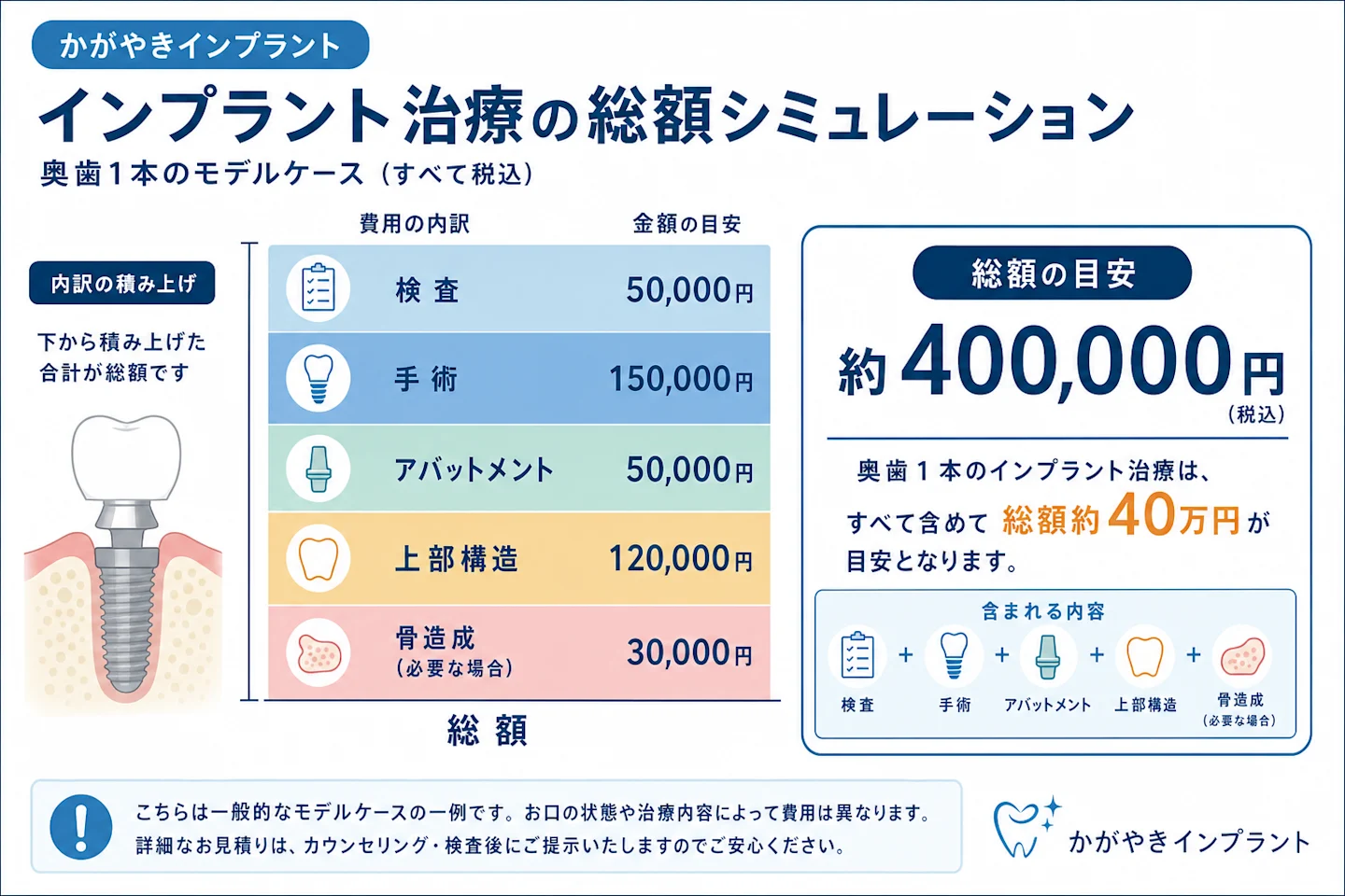 インプラント治療の総額シミュレーション（内訳の積み上げで奥歯1本約40万円のモデルケース）