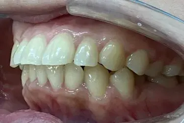 Before Image