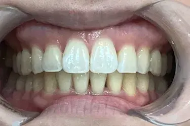After Image