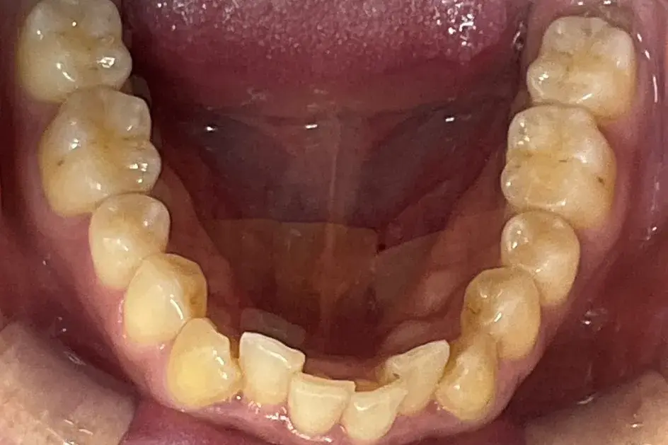 Before Image