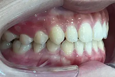 After Image