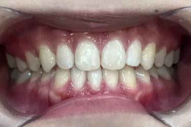 After Image