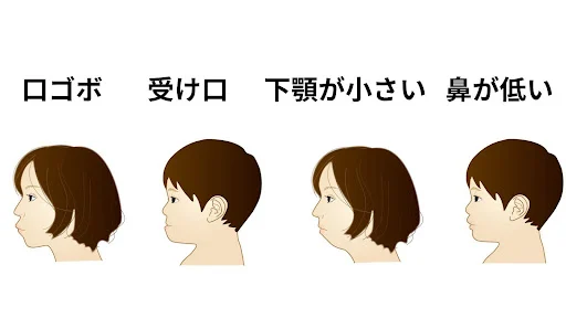理想的なEラインにならない原因