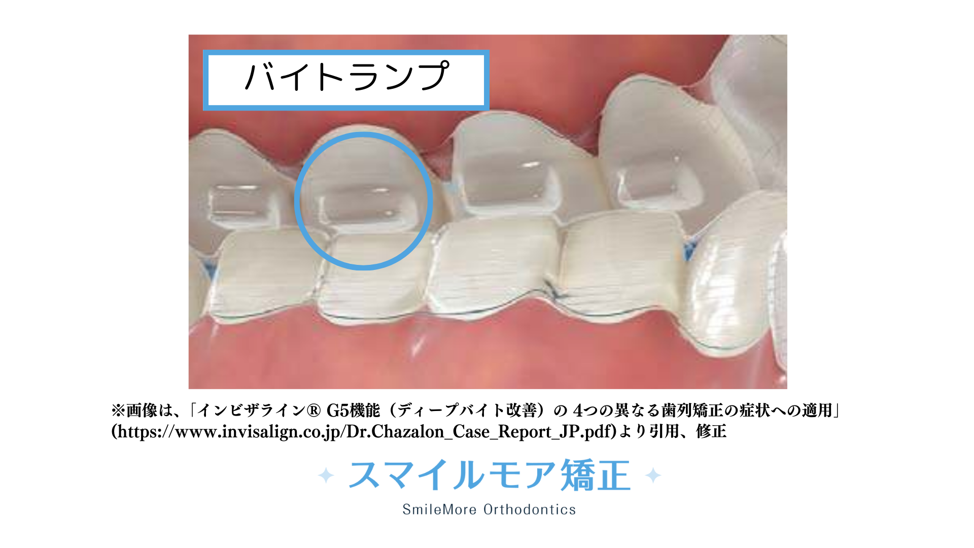 バイトランプ