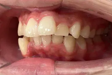 Before Image