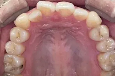 Before Image