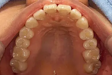 After Image