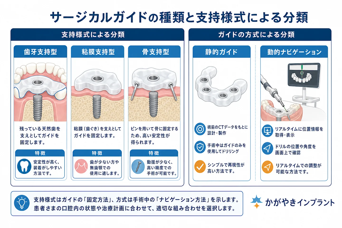 サージカルガイドの種類と支持様式による分類を示すチャート図