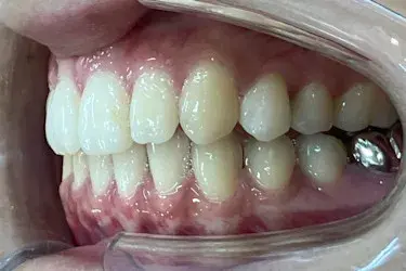 After Image