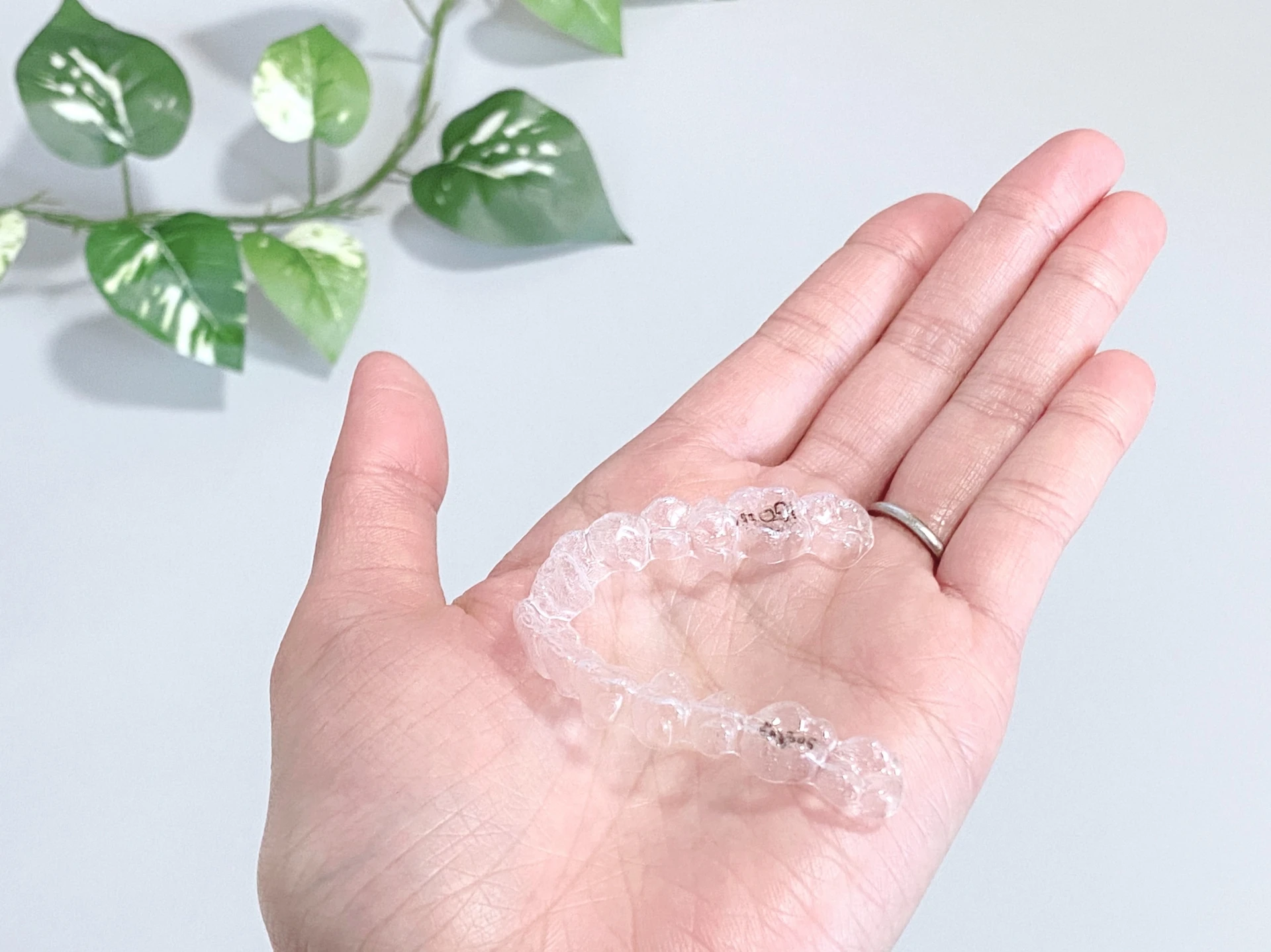 出っ歯のお悩みなら、スマイルモア矯正