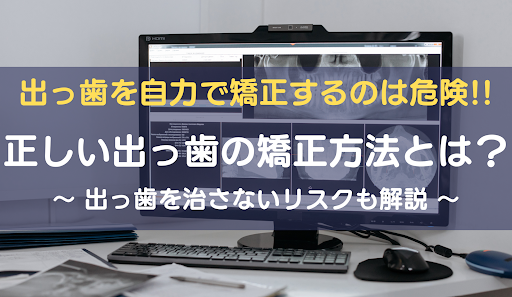 ひどい出っ歯アイキャッチ画像