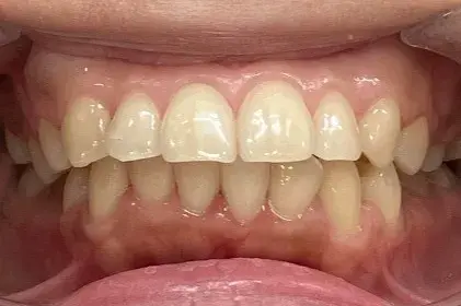 Before Image