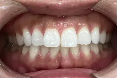 Before Image