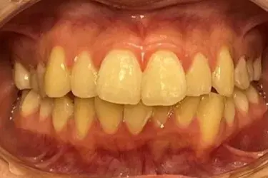 Before Image