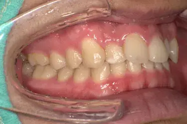 Before Image