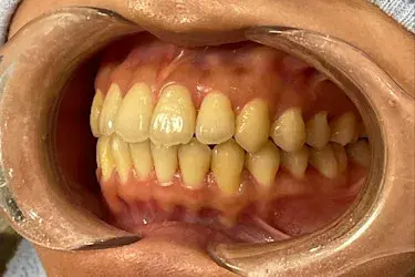 After Image