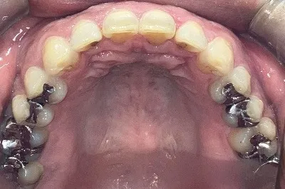 After Image