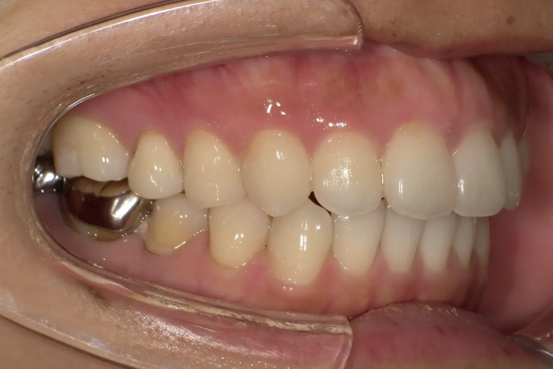 After Image