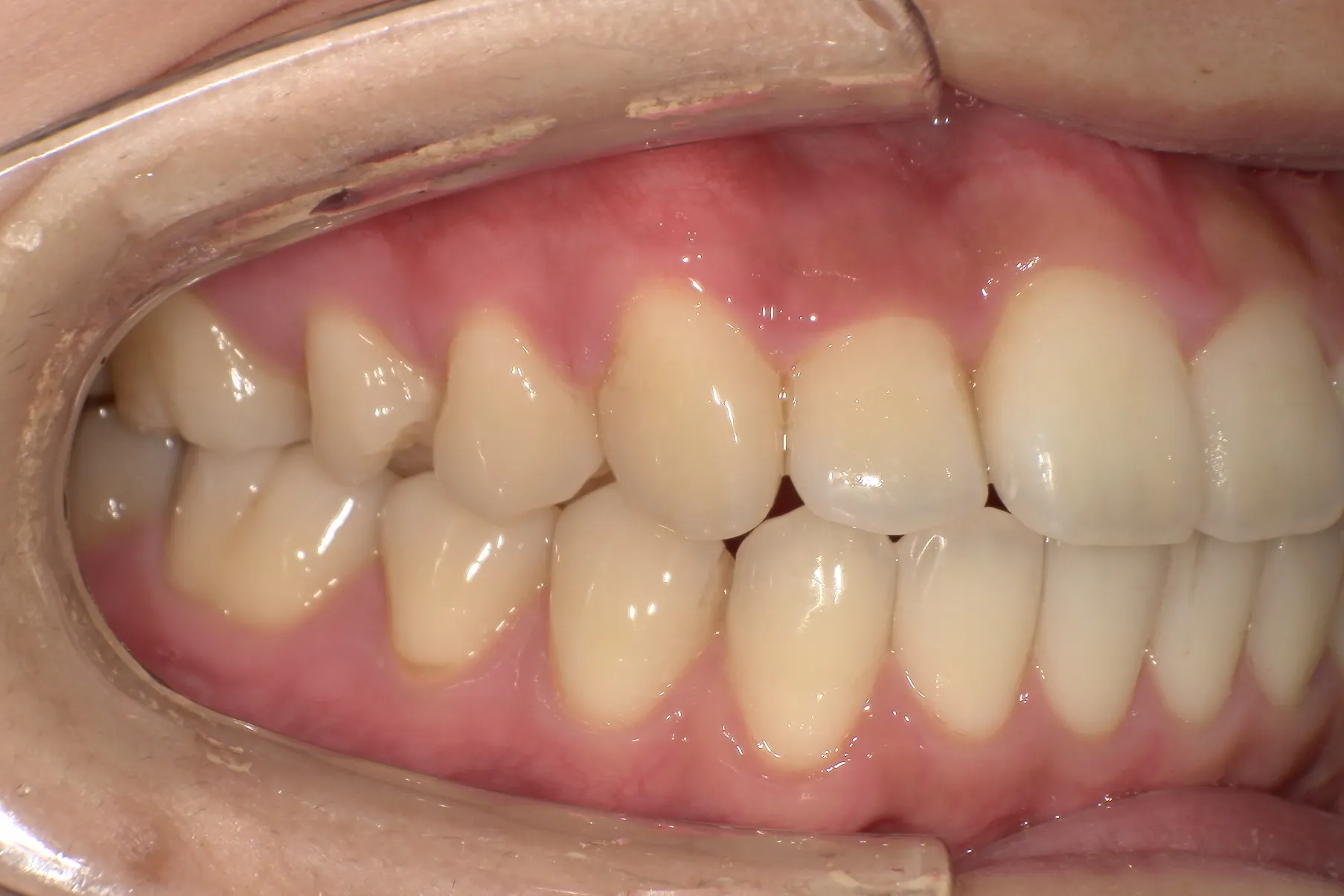 After Image
