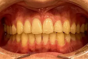 After Image