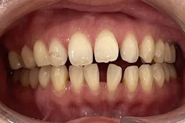 Before Image