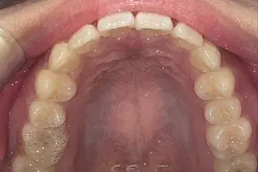 After Image