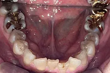 Before Image