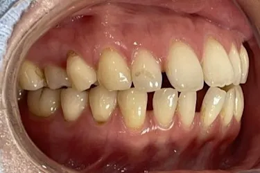 Before Image