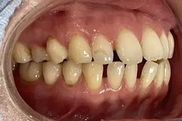 Before Image