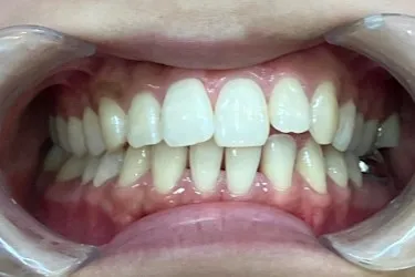 Before Image