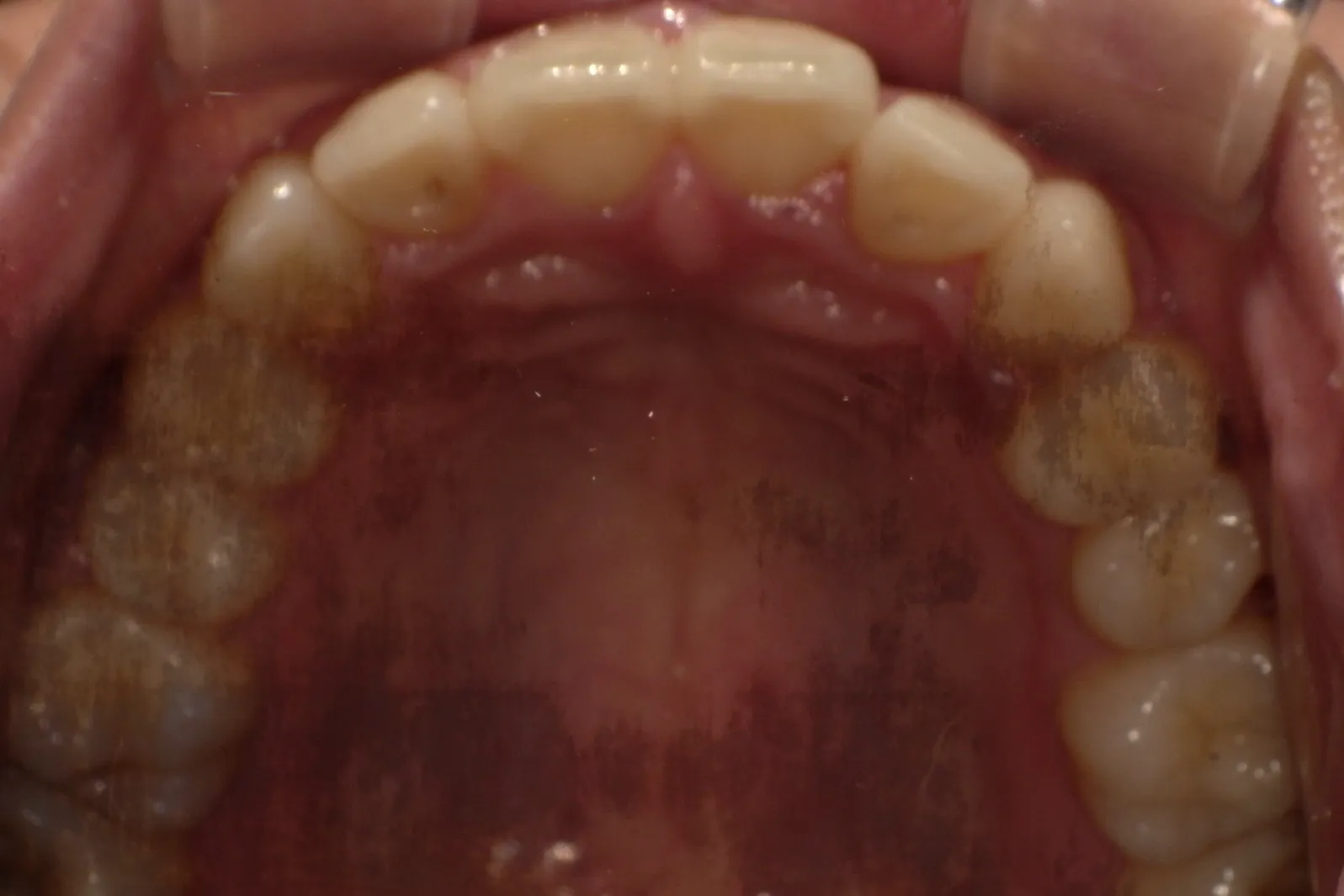 After Image