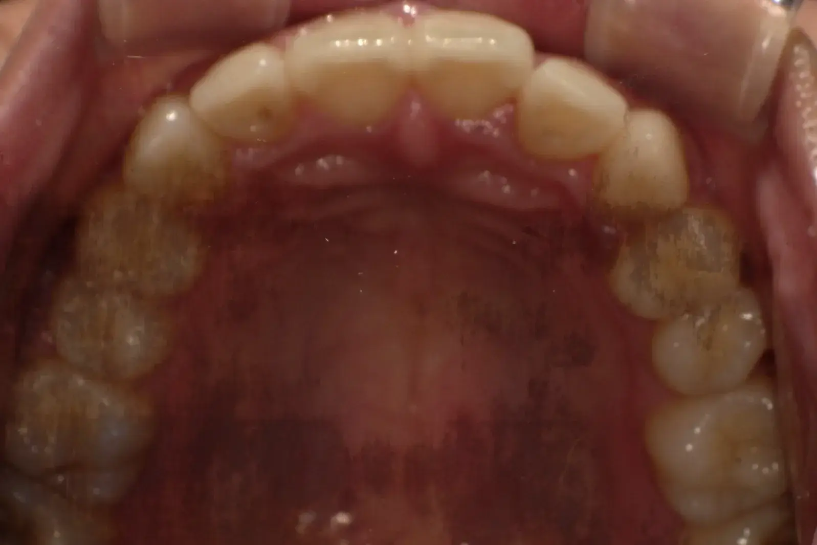 After Image