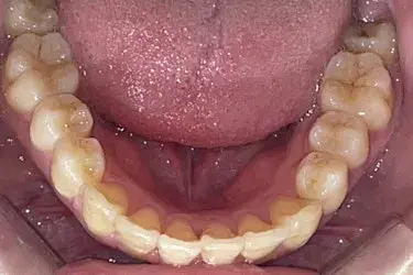 After Image