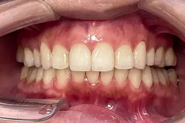 After Image