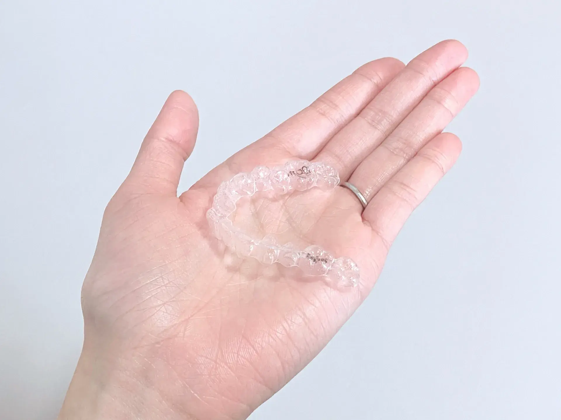 インビザラインの追加費用を発生させないためにできること