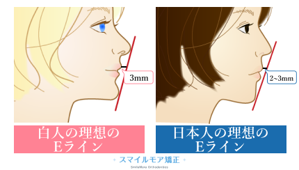 白人と日本人のEラインの違い