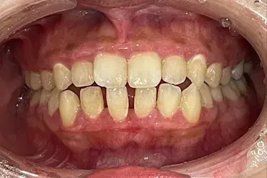 Before Image