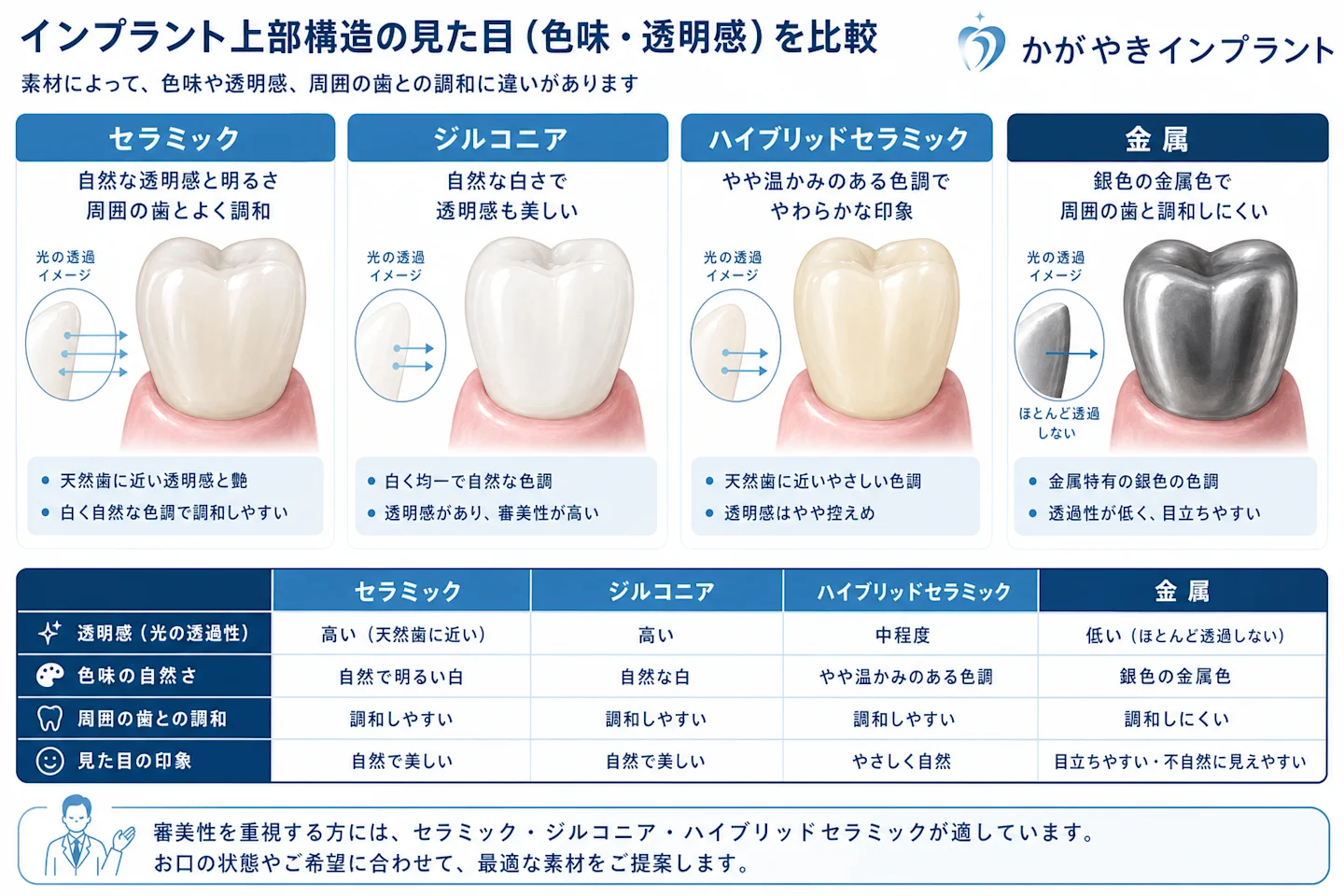 インプラント上部構造の素材別の見た目(色味・透明感)を比較したイメージ図