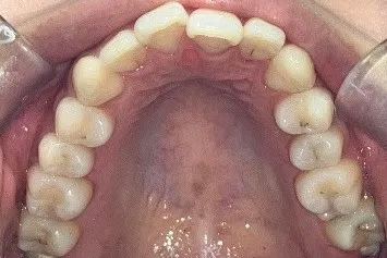 Before Image
