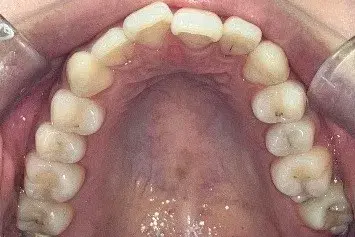 Before Image