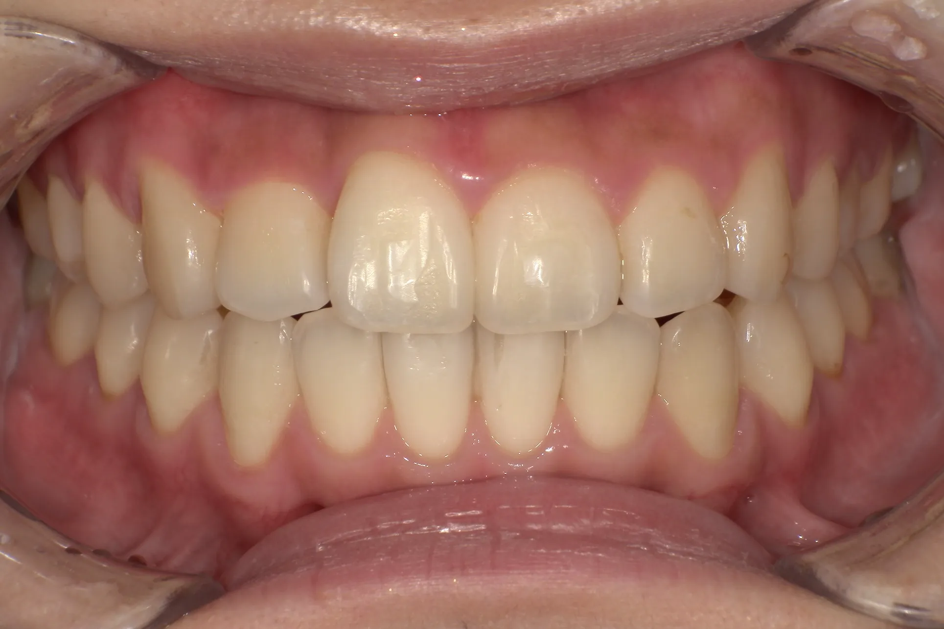 After Image