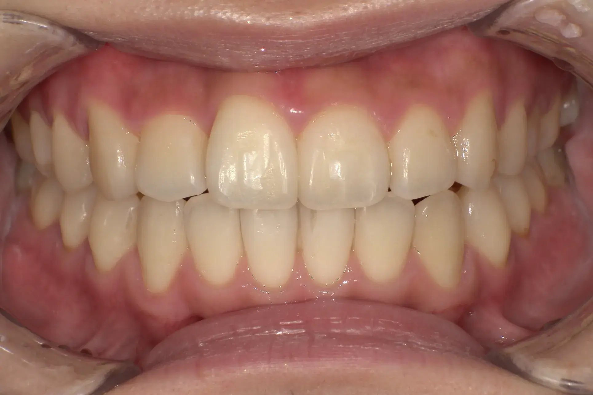 After Image