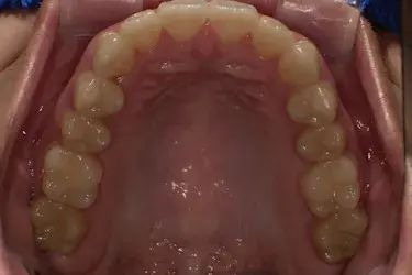 After Image